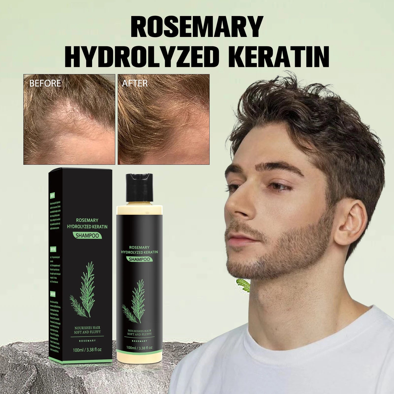Rosemary Hair Growth & Anti-Baldness Shampoo - Deeply Nourishes, Repairs Split Ends, Soothes Scalp & Fights Dandruff.